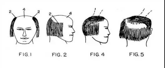 五款防止脫發(fā)的“正經(jīng)”專(zhuān)利！