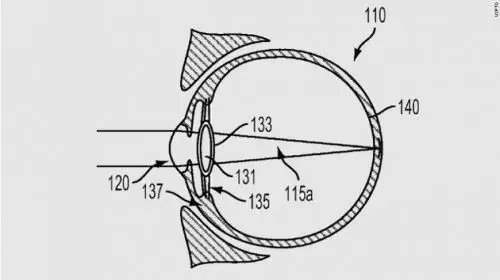 科技 | 谷歌把“電子眼注入眼球”，專利申請(qǐng)能否通過(guò)？